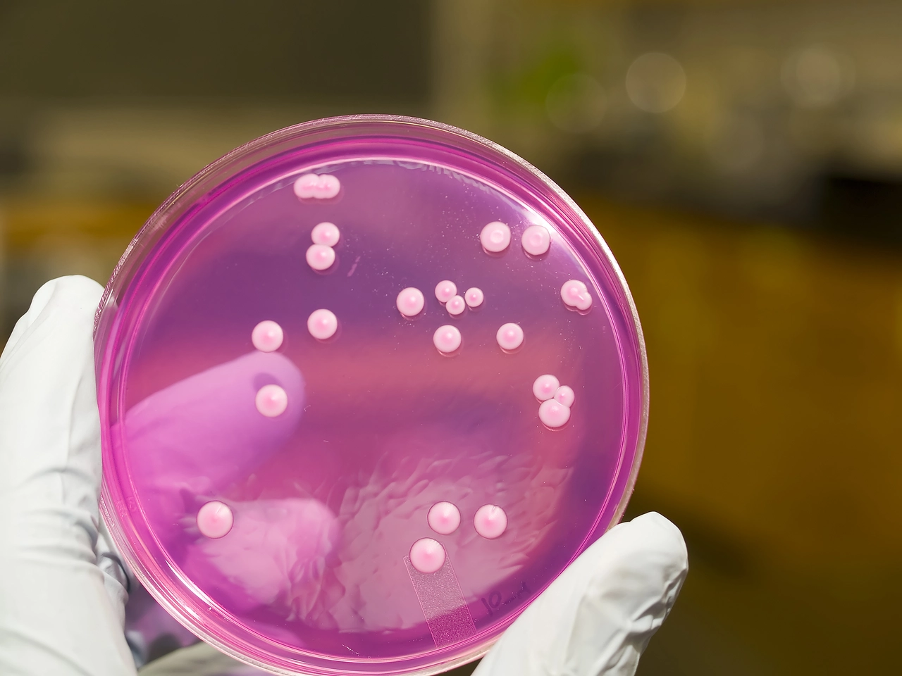 El lugar que nunca limpias y acumula más bacterias que el inodoro: descúbrelo