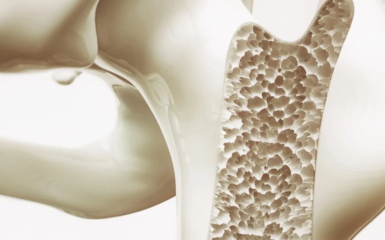 ¿Tienes osteoporosis? Descubre si puedes solicitar una pensión por incapacidad y cómo hacerlo